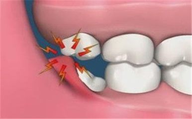 拔牙打麻药ppt,拔牙打麻药位置图解